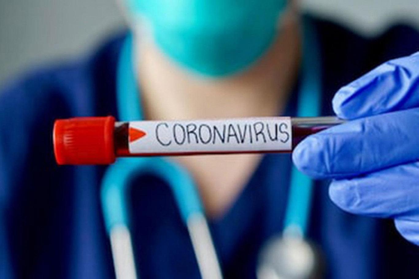İtalya'da Coronavirus nedeni ile ölenlerin sayısı 34 bin 899 oldu